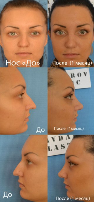 Что делать, если отходит ноготь на ноге: причины, лечение Школьный юмор шутки про школу, учителей, статусы, анекдоты
