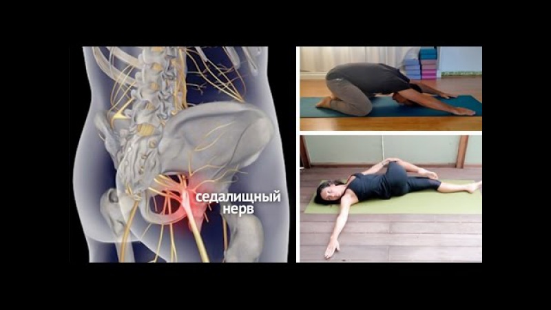 Защемило спину в домашних условиях 694