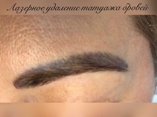 Татуаж бровей это безопасно Татуаж бровей это безопасно