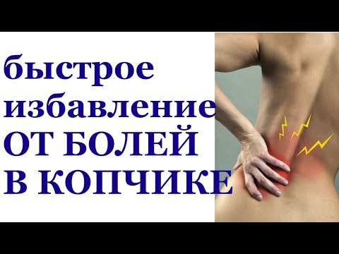 Боль при сидении копчика лечение в домашних 292