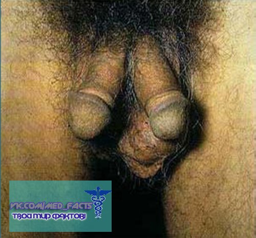 ���� ����� ���� �������� ��������� ������� ����