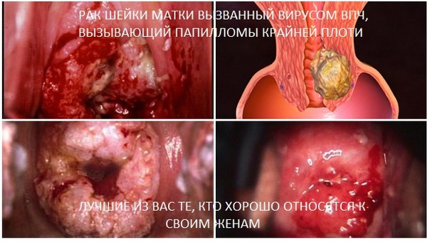 фото обрезанных женщин онлайн фото обрезанных женщин