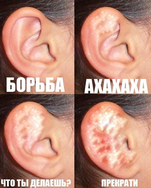 Как Сломать Ухо - catalogdiamond