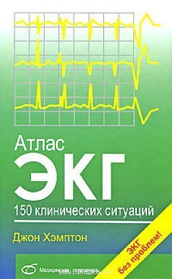Атлас ЭКГ. 150 клинических ситуаций. Хэмптон Дж.