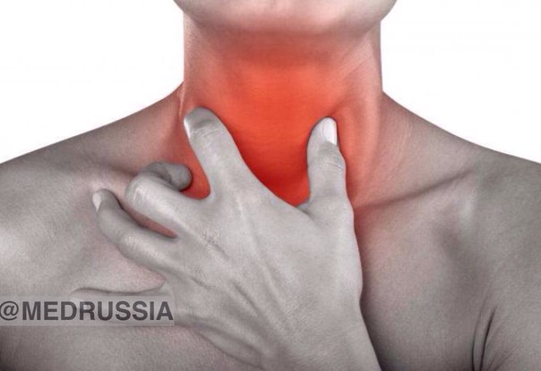 Хронический тонзиллит