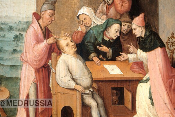 7 самых странных способов лечения в истории медицины