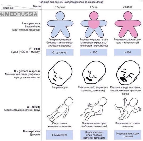 Шкала Апгар - мнемоническая запоминалка. Шкала Апгар - мнемоническая запоминалка.