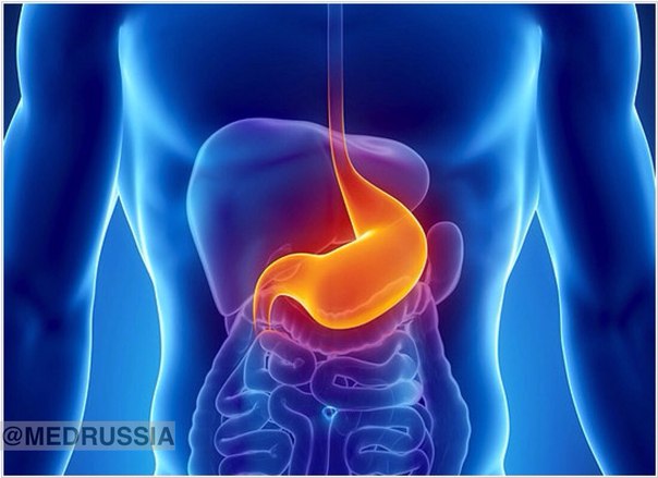 Для какого заболевания характерна гипертония нижнего пищеводного сфинктера
