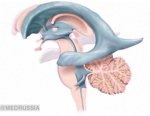 Желудочки мозга. 