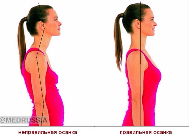 Почему и как нужно держать спину прямо 
