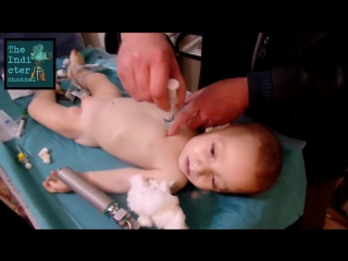 The White Helmets video and How to NOT correctly perform intracardiac injection