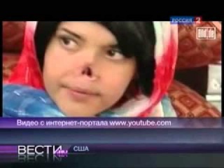 Афганской девушке муж-талиб отрезал нос