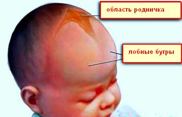 фото родничок у новорожденного онлайн фото родничок у новорожденного