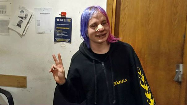 В Киеве жестоко избили британского туриста из-за розовых волос