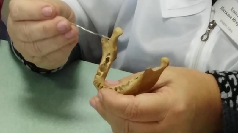 Нижняя челюсть ( Mandibula)