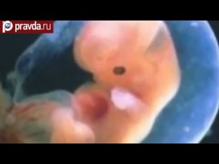Аборт: убийство или спасение?