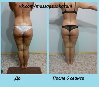 Через сколько эффект от антицеллюлитного массажа Через сколько эффект от антицеллюлитного массажа