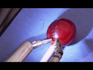 Incredible: Robot Stitches A Grape Back Together!