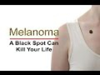 Melanoma – A Common Type of Skin Cancer