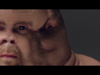 The only person to survive on our roads- Meet Graham, TAC 2016