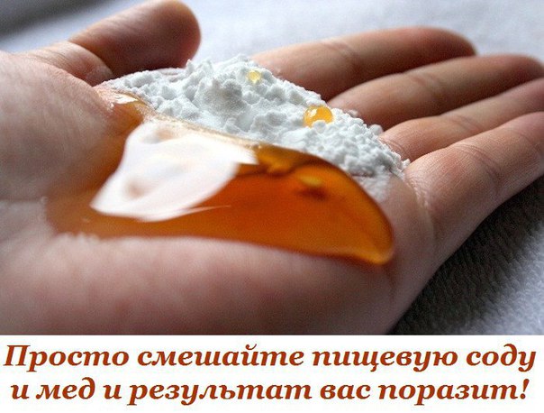 Просто cмешайте пищевую соду и мед: Потребляйте 3 чайные ложки в день в течение 30 дней, и вот что произойдет с вашим телом! 