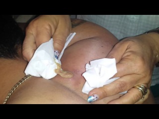 The Volcanic Cyst Infection 1| Health & Life