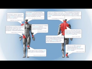 Fascial Manipulation® по Луиджи Стекко, что это? (англ.)