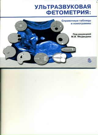 Митьков Узи Торрент