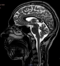 Игорь Ратников