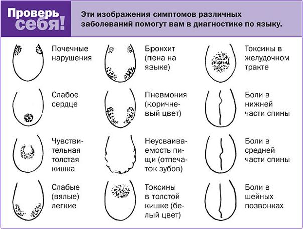 ВАШ ЯЗЫК КАК ИНДИКАТОР, ПОМОГАЕТ ОПРЕДЕЛИТЬ БОЛЕЗНИ 