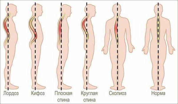 УПРАЖНЕНИЯ ДЛЯ ПРОФИЛАКТИКИ СУТУЛОСТИ 