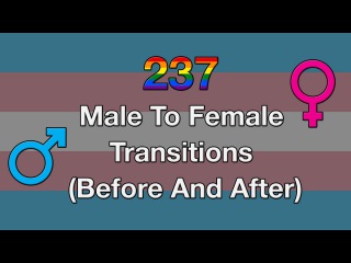 237 Male To Female Transitions (Before And After)