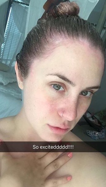Mtf freckles snapchat drunk