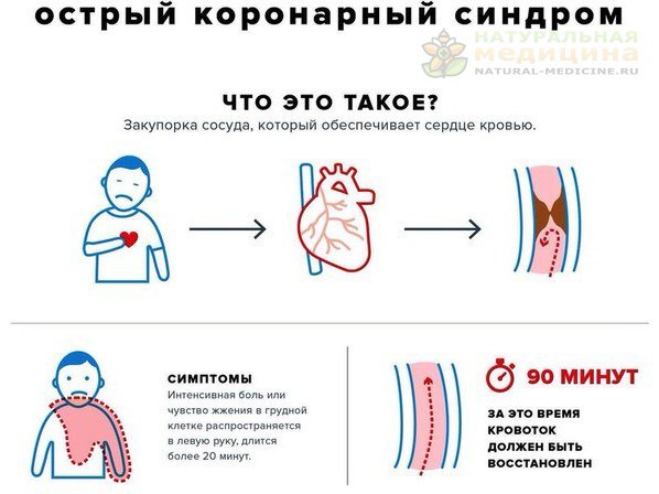 Ocтрый коронарный cиндром 
