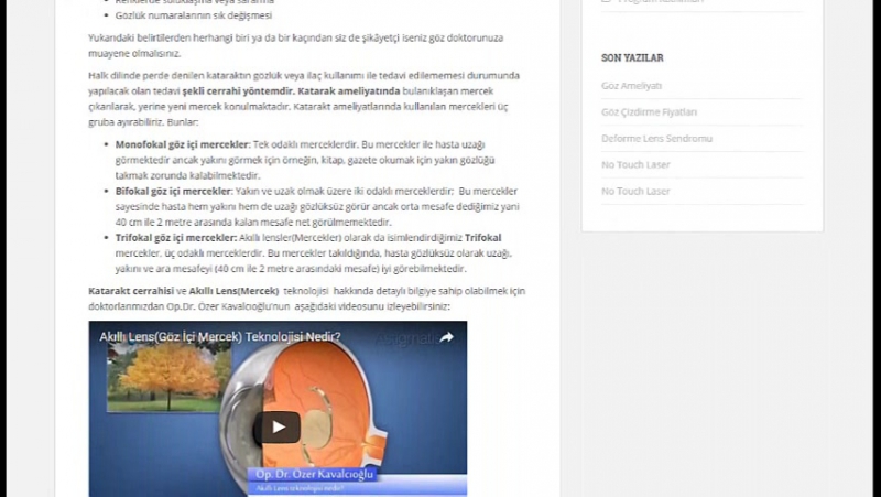 Katarakt ameliyatı
