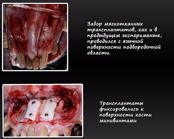 #статьи_alldental