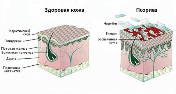 Болезни кожи и их лечение