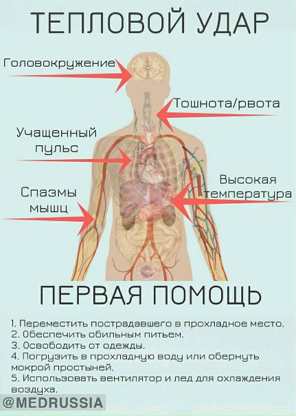Тепловой удар. Первая помощь