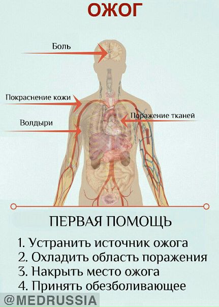 СКОРАЯ ПОМОЩЬ ПРИ ОЖОГАХ