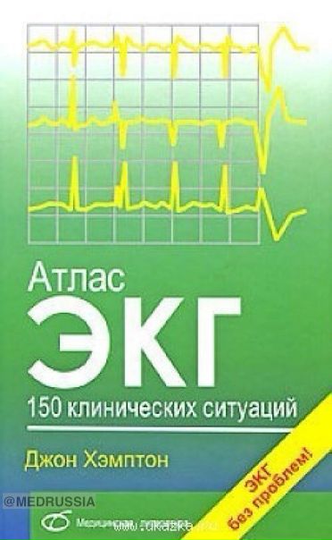 Атлас ЭКГ. 150 клинических ситуаций. Хэмптон Дж., 2008.