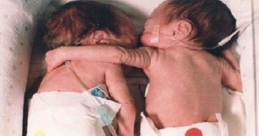 Она обняла свою ослабевшую сестру. То, что произошло потом, не ожидал никто  полностью в источнике...
