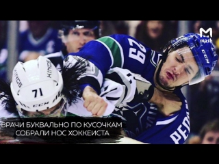 Хоккеисту Андрею Педану по кусочкам собирали нос