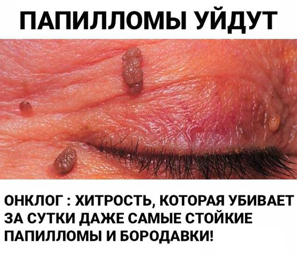 винкс мультфильмы 2 сезон