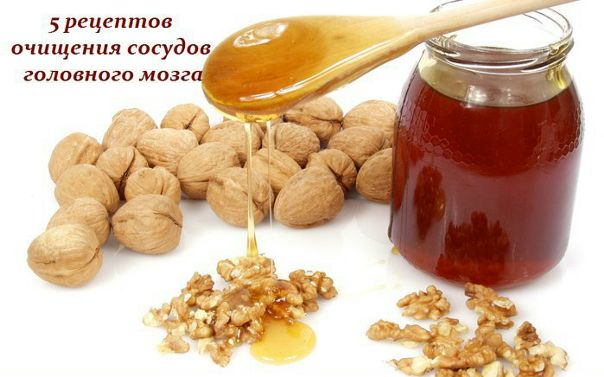 Очищение сосудов головного мозга. Проверенные методики 