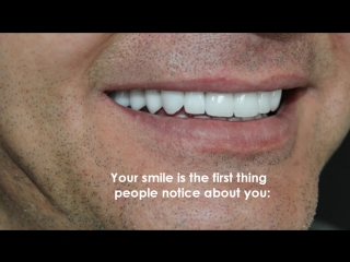 Dr- Azamat -Tekuyev - Smile-Designer - stomatologiya - BEFORE AFTER-Instagram