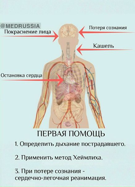 Первая помощь. Инородное тело в дыхательных путях