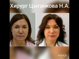 Как увеличить в объеме толщине и диаметре Утолщение члена
