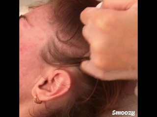 Мезотерапия для роста волос dr. LAA
