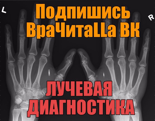  Лучевая диагностика. Цикл наглядных презентаций.