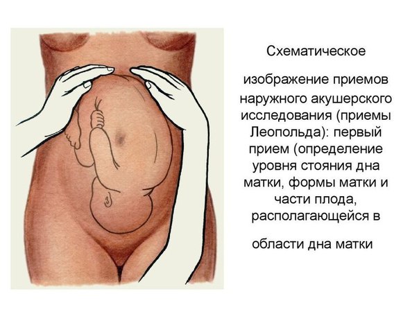  Акушерство. Приёмы Леопольда.